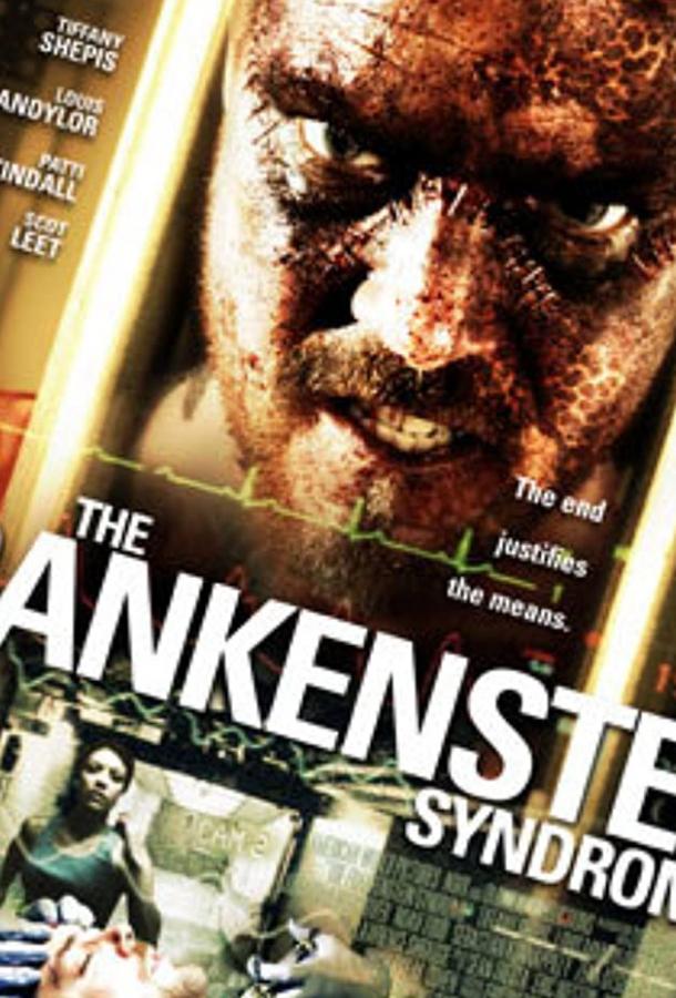 Синдром Франкенштейна Синдром Франкенштейна