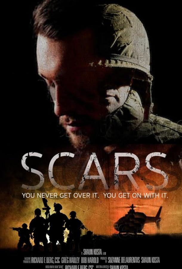 Шрамы Шрамы