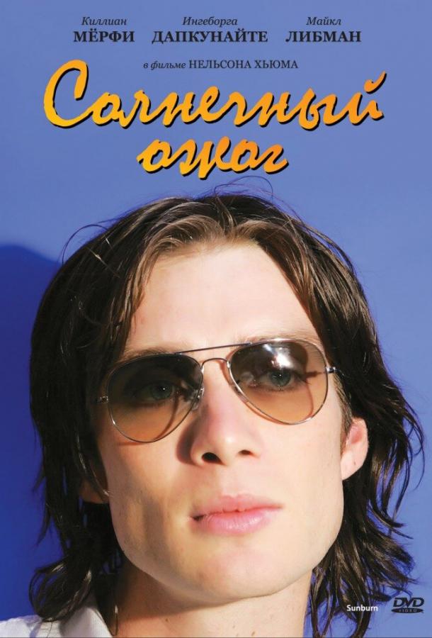 Солнечный ожог Солнечный ожог